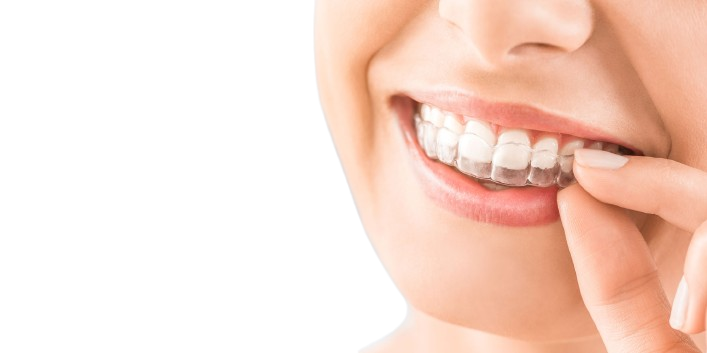 Affordable Orthodontics and Braces in Karachi at AlKhaleej Clinics